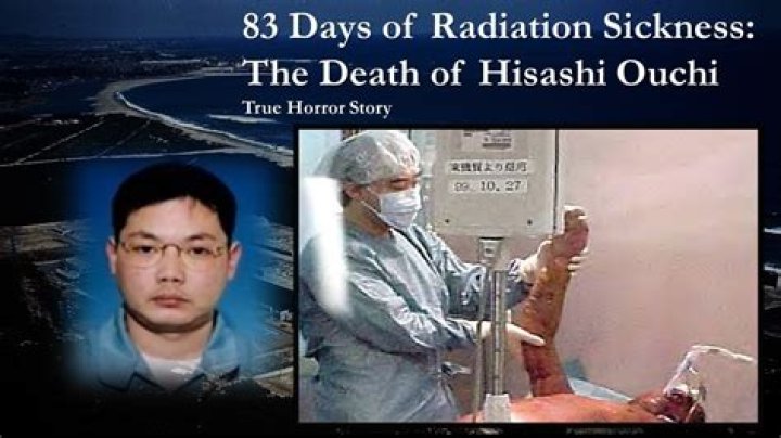 Hisashi Ouchi After Radiation: A Look at His Agonizing 83 Days