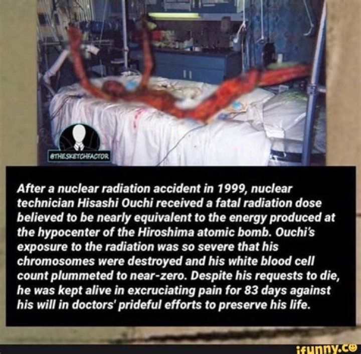 The Enduring Impact of the Hisashi Ouchi Photo: A Look at Radiation's True Cost